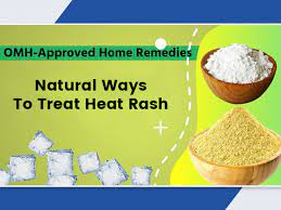 home remes to treat heat rash