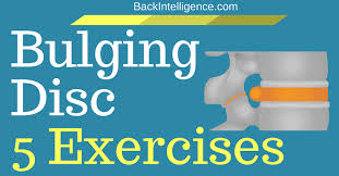 bulging disc exercises in lower back
