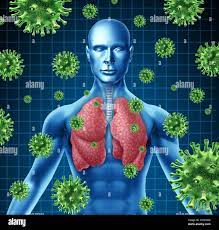 Infección pulmonar representada por un humano con la imagen de rayos x de los pulmones y el cuerpo con células que atacan el virus a un estado de paciente Fotografía de stock -