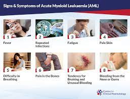 What Are The Signs Of Aml gambar png