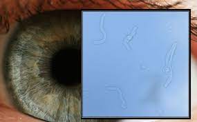 the eye floater phenomenon between