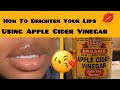 your lips using apple cider vinegar