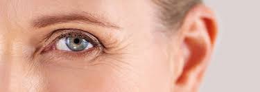 here s what you can do about eye wrinkles