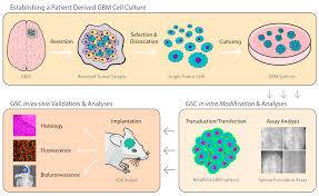 patient derived glioma