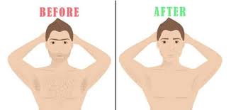 The standards of the waxing industry recommend the length to be a quarter to an eighth of ingrowns can happen when a hair gets trapped beneath the skin. How Long Waxing Chest Hair Lasts And How To Prolong It Ready Sleek