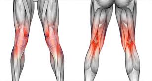 knee pain sudden onset gradual