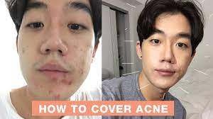 how to cover acne with makeup 5 steps