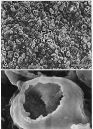 Photomicrographs Of Scanning Electron Microscopy Sem A And B And