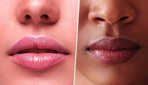 6 remes to get rid of dark lips