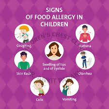 food allergy what are the most common