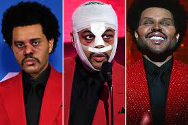 Слушать песни и музыку the weeknd онлайн. The Weeknd S Face From Bloody Horror To Surgery Shocker