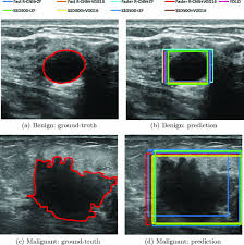What does the equipment look like? Breast Tumor Detection In Ultrasound Images Using Deep Learning Springerlink