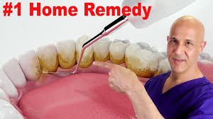1 home remedy to remove dental plaque
