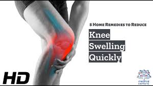 knee swelling ne 8 effective home