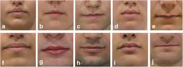 lip fullness clification of the