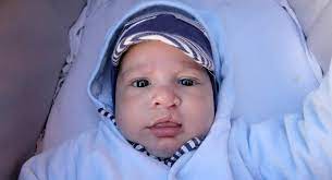 cleft lip and palate diagnosis causes