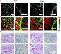 Quad cap pro is the successor of the quad cap maxscript. In Vitro And In Vivo Osteogenesis Up Regulated By Two Dimensional Nanosheets Through A Macrophage Mediated Pathway Biomaterials Science Rsc Publishing