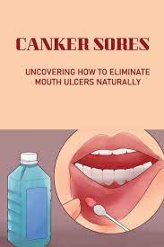 canker sores uncovering how to