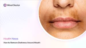 how to remove darkness around mouth