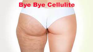 say bye bye to cellulite in just