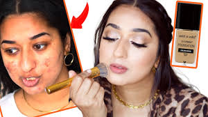 hindi video how to cover acne scars