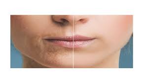your lips can speak your age here s how
