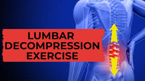 what is spinal decompression therapy