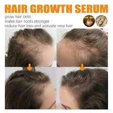 2x hair growth spray castor oil hair
