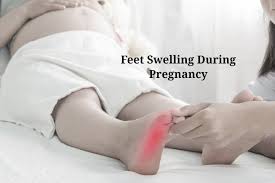 feet swelling during pregnancy being