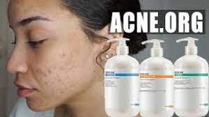 skincare routine acne org