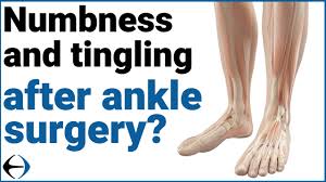 tingling after ankle surgery