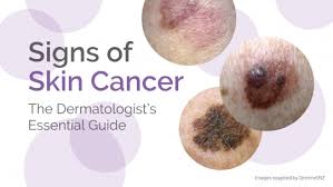 skin cancer types symptoms causes