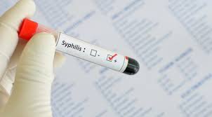 Imagini pentru test pentru sifilis