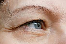 ptosis causes and treatment fort