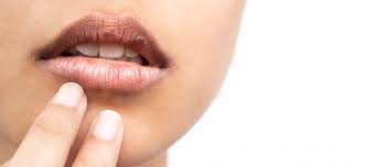dry mouth syndrome symptoms causes