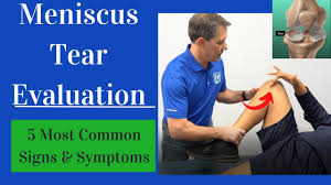 meniscus tear evaluation 5 most common