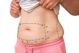liposuction cost s and specials