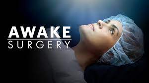 series awake surgery premiere