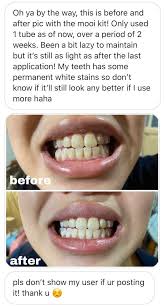 mooi teeth whitening home kit mooi beauty