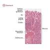 Mucosa is made of epithelial tissue. 1