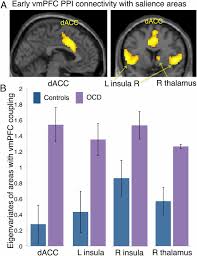 Neural Basis Of Impaired Safety Signaling In Obsessive