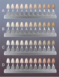 Precise Color Matching Rockefeller Cosmetic Dentistry
