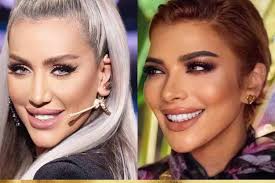 arab female celebrities with smile veneers