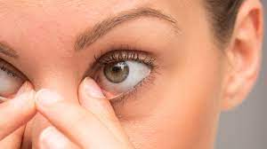 here s what s really causing your stye