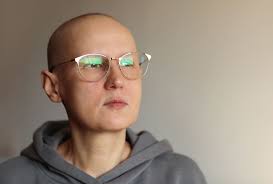coping with hair loss during chemotherapy