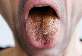 your tongue say about your health