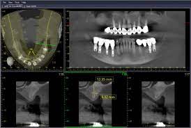 dental ti blog dental imaging