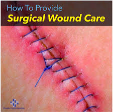 providing surgical wound care and
