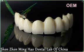 Porcelain Metal Crown Pfm Non Precious From Shenzhen Minghao Dental Lab