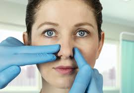 A deviated septum is a structural abnormality in the nose that can lead to chronic congestion and breathing difficulties. Deviated Septum Red River Ent Associates